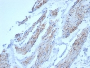 IHC staining of FFPE dog smooth muscle tissue with Desmin antibody (clone DES/3255) at 2ug/ml. HIER: boil tissue sections in pH 9 10mM Tris with 1mM EDTA for 20 min and allow to cool before testing.