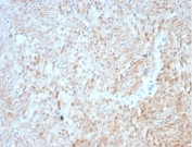 IHC staining of FFPE cat smooth muscle tissue with Desmin antibody (clone DES/3255) at 2ug/ml. HIER: boil tissue sections in pH 9 10mM Tris with 1mM EDTA for 20 min and allow to cool before testing.