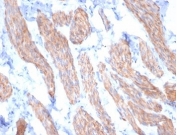 IHC staining of FFPE horse smooth muscle tissue withe Desmin antibody (clone DES/3255) at 2ug/ml. HIER: boil tissue sections in pH 9 10mM Tris with 1mM EDTA for 20 min and allow to cool before testing.