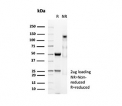 SDS-PAGE analysis of purified, BSA-free Desmin antibody (clone DES/3255) as confirmation of integrity and purity.