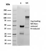 SDS-PAGE analysis of purified, BSA-free recombinant ERa antibody (clone ESR1/4039R) as confirmation of integrity and purity.