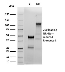 SDS-PAGE analysis of purified, BSA-free recombinant ERa antibody (clone ESR1/4039R) as confirmation of integrity and purity.