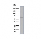 Western blot testing of human MCF-7 cell lysate using recombinant ESR1 antibody (clone ESR1/6983R).