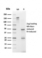SDS-PAGE analysis of purified, BSA-free FABP1 antibody (clone FABP1/3940) as confirmation of integrity and purity.