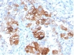 IHC staining of FFPE human kidney tissue with FABP1 antibody (clone FABP1/3940). HIER: boil tissue sections in pH 9 10mM Tris with 1mM EDTA for 20 min and allow to cool before testing.