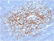 IHC staining of FFPE human lymph node with CD23 antibody (clone FCER2/6891) at 2ug/ml in PBS for 30min RT. HIER: boil tissue sections in pH 9 10mM Tris with 1mM EDTA for 20 min and allow to cool before testing.