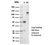 SDS-PAGE analysis of purified, BSA-free recombinant CD45RA antibody (clone PTPRC/7018R) as confirmation of integrity and purity.