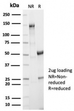 SDS-PAGE analysis of purified, BSA-free recombinant Aldose reductase antibody (AKR1B1/7010R) as confirmation of integrity and purity.