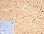 IHC staining of FFPE human brain tissue with recombinant Aldose reductase antibody (clone AKR1B1/7010R) at 2ug/ml in PBS for 30 min RT. Negative control inset: PBS used instead of primary antibody to control for secondary Ab binding. HIER: boil tissue sections in pH 9 10mM Tris with 1mM EDTA for 20 min and allow to cool before testing.