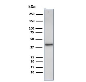 Western blot analysis of human A431 cell lysate using recombinant Filaggrin antibody (clone FLG/3909R). Expected molecular weight: ~434 kDa (precursor); 37-45 kDa (processed).