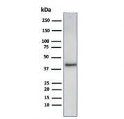 Western blot analysis of human A431 cell lysate using recombinant Filaggrin antibody (clone FLG/3909R). Expected molecular weight: ~434 kDa (precursor); 37-45 kDa (processed).