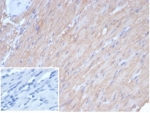 IHC staining of FFPE human smooth muscle tissue with recombinant CALD1 antibody (clone rCALD1/7266). Negative control inset: PBS instead of primary antibody to control for secondary binding. HIER: boil tissue sections in pH 9 10mM Tris with 1mM EDTA for 20 min and allow to cool before testing.