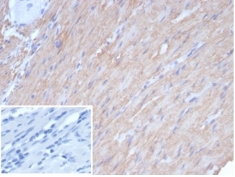 IHC staining of FFPE human smooth musc