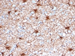 IHC staining of FFPE human cerebellum tissue with Glial Fibrillary Acidic Protein antibody (clone GFAP/4450). HIER: boil tissue sections in pH 9 10mM Tris with 1mM EDTA for 20 min and allow to cool before testing.