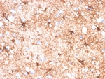 IHC staining of FFPE human cerebellum tissue with Glial Fibrillary Acidic Protein antibody (clone GFAP/4450). HIER: boil tissue sections in pH 9 10mM Tris with 1mM EDTA for 20 min and allow to cool before testing.