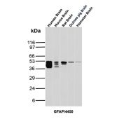 GFAP Antibody Brain Tissue WB. Western blot analysis of human brain, mouse brain, rat brain, guinea pig brain, and hamster brain tissue lysates using Glial fibrillary acidic protein Antibody clone GFAP/4450. A prominent band is detected at approximately 50 kDa across multiple mammalian brain samples, consistent with the predicted molecular weight of GFAP, a major astrocytic intermediate filament protein expressed throughout the central nervous system. Additional lower molecular weight bands observed primarily in human, mouse, and rat brain lysates likely represent GFAP isoforms and/or partial proteolytic processing products commonly detected in neural tissue extracts.