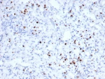 IHC staining of FFPE human tonsil tissue with recombinant GZMB antibody (clone rGZMB/6740). HIER: boil tissue sections in pH 9 10mM Tris with 1mM EDTA for 20 min and allow to cool before testing.~