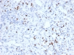 IHC staining of FFPE human tonsil tissue with recombinant GZMB antibody (clone rGZMB/6740). HIER: boil tissue sections in pH 9 10mM Tris with 1mM EDTA for 20 min and allow to cool before testing.