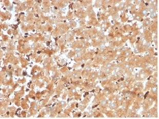 IHC staining of FFPE human liver tissue with Haptoglobin antibody (clone HP/3840) at 2ug/ml. HIER: boil tissue sections in pH 9 10mM Tris with 1mM EDTA for 20 min and allow to cool before testing.