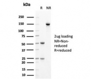 SDS-PAGE analysis of purified, BSA-free KRT14 antibody (clone KRT14/4125) as confirmation of integrity and purity.