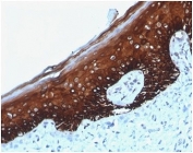 IHC staining of FFPE human skin with KRT14 antibody (clone KRT14/4125) at 2ug/ml. HIER: boil tissue sections in pH 9 10mM Tris with 1mM EDTA for 20 min and allow to cool before testing.