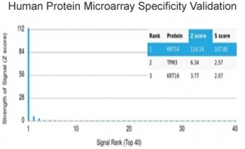 Analysis of HuProt(TM) microarray containing more than 19,000 full-length human proteins using KRT14 antibody (clone KRT14/4125). These results demonstrate the foremost specificity of the KRT14/4125 mAb. Z- and S- score: The Z-score represents the strength of a signal that an antibody (in combination with a fluorescently-tagged anti-IgG secondary Ab) produces when binding to a particular protein on the HuProt(TM) array. Z-scores are described in units of standard deviations (SD's) above the mean value of all signals generated on that array. If the targets on the HuProt(TM) are arranged in descending order of the Z-score, the S-score is the difference (also in units of SD's) between the Z-scores. The S-score therefore represents the relative target specificity of an Ab to its intended target.
