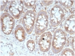 IHC staining of FFPE human colon tissue with 40S Ribosomal protein SA (clone RPSA/6332R). HIER: boil tissue sections in pH 9 10mM Tris with 1mM EDTA for 20 min and allow to cool before testing.
