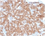 IHC staining of FFPE human pancreas with 40S Ribosomal protein SA antibody (clone RPSA/6332R). HIER: boil tissue sections in pH 9 10mM Tris with 1mM EDTA for 20 min and allow to cool before testing.