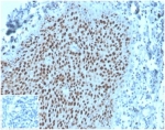 IHC staining of FFPE human tonsil tissue with MCM2 antibody (clone MCM2/3678). Negative control inset: PBS instead of primary antibody to control for secondary binding. HIER: boil tissue sections in pH 9 10mM Tris with 1mM EDTA for 20 min and allow to cool before testing.
