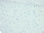 Negative control: IHC staining of FFPE human brain tissue with CD10 antibody (clone MME/6714) at 2ug/ml in PBS for 30min RT. HIER: boil tissue sections in pH 9 10mM Tris with 1mM EDTA for 20 min and allow to cool before testing.