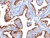 IHC staining of FFPE human prostate tissue with CD10 antibody (clone MME/6714). HIER: boil tissue sections in pH 9 10mM Tris with 1mM EDTA for 20 min and allow to cool before testing.