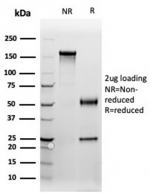 SDS-PAGE analysis of purified, BSA-free PGR antibody (clone PGR/3817) as confirmation of integrity and purity.