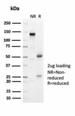 SDS-PAGE analysis of purified, BSA-free recombinant Geminin antibody (clone GMNN/7037R) as confirmation of integrity and purity.