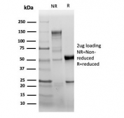 SDS-PAGE analysis of purified, BSA-free recombinant PECAM-1 antibody (clone C31/6446R).