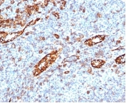 IHC staining of FFPE human tonsil tissue with recombinant PECAM-1 antibody (clone C31/6446R). HIER: boil tissue sections in pH 9 10mM Tris with 1mM EDTA for 20 min and allow to cool before testing.