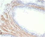 IHC staining of FFPE human prostate tissue with recombinant Aciculin antibody (clone PGM5/7005R) at 2ug/ml. HIER: boil tissue sections in pH 9 10mM Tris with 1mM EDTA for 20 min and allow to cool before testing.