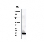 Western blot analysis of human heart tissue lysate using Resistin antibody (clone RETN/4324). Predicted molecular weight ~11 kDa.