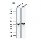 Western blot testing of mouse NIH 3T3 cell and human kidney tissue lysate with recombinant Actin antibody. 