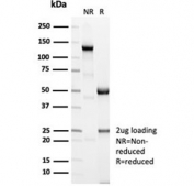 SDS-PAGE analysis of purified, BSA-free recombinant ACTN2 antibody (clone ACTN2/7039R) as confirmation of integrity and purity.