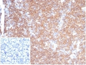 IHC staining of FFPE human tonsil tissue with recombinant CD45RA antibody (clone rPTPRC/7283). Negative control inset: PBS instead of primary antibody to control for secondary binding. HIER: boil tissue sections in pH 9 10mM Tris with 1mM EDTA for 20 min and allow to cool before testing.