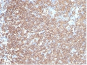 IHC staining of FFPE human tonsil tissue with recombinant CD45RA antibody (clone rPTPRC/7283). HIER: boil tissue sections in pH 9 10mM Tris with 1mM EDTA for 20 min and allow to cool before testing.