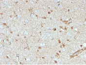 IHC staining of FFPE human brain tissue with S100B antibody (clone S100B/4153) at 2ug/ml. HIER: boil tissue sections in pH 9 10mM Tris with 1mM EDTA for 20 min and allow to cool before testing.