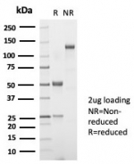 SDS-PAGE analysis of purified, BSA-free recombinant TSH beta antibody (clone TSHb/7001R) as confirmation of integrity and purity.
