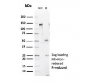 SDS-PAGE analysis of purified, BSA-free recombinant CAD antibody (clone CALD1/7024R) as confirmation of integrity and purity.