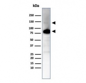 Western blot testing of human ovary tissue lysate using recombinant CAD antibody (clone CALD1/7024R). Predicted molecular weight ~93 kDa, can be observed at 70-80 kDa (non muscle tissue) and 120-150 kDa (smooth muscle).