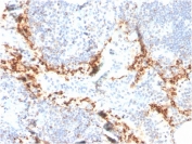 IHC staining of FFPE human lymph node with HAVCR2 antibody (clone TIM3/4024). HIER: boil tissue sections in pH 9 10mM Tris with 1mM EDTA for 20 min and allow to cool before testing.
