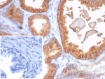 IHC staining of FFPE human prostate tissue with recombinant Beta-2 Microglobulin antibody (clone rB2M/7279). Negative control inset: PBS instead of primary antibody to control for secondary binding. HIER: boil tissue sections in pH 9 10mM Tris with 1mM EDTA for 20 min and allow to cool before testing.