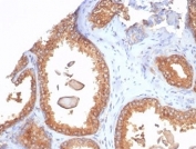 IHC staining of FFPE human prostate tissue with recombinant Beta-2 Microglobulin antibody (clone rB2M/7279). HIER: boil tissue sections in pH 9 10mM Tris with 1mM EDTA for 20 min and allow to cool before testing.