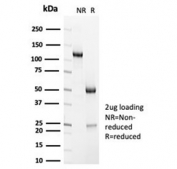 SDS-PAGE analysis of purified, BSA-free recombinant Alpha Actinin 2 antibody (clone ACTN2/7040R) as confirmation of integrity and purity.