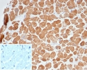 IHC staining of FFPE human cardiac muscle with recombinant Alpha Actinin 2 antibody (clone ACTN2/7040R). Negative control inset: PBS used instead of primary antibody to control for secondary Ab binding. HIER: boil tissue sections in pH 9 10mM Tris with 1mM EDTA for 20 min and allow to cool before testing.